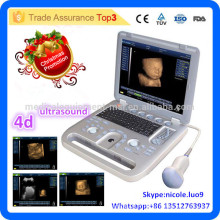 Promotion de Noël! CU18-I Nouveau Advanced 15in LED 4D PC Portable Ultrasound Scanner